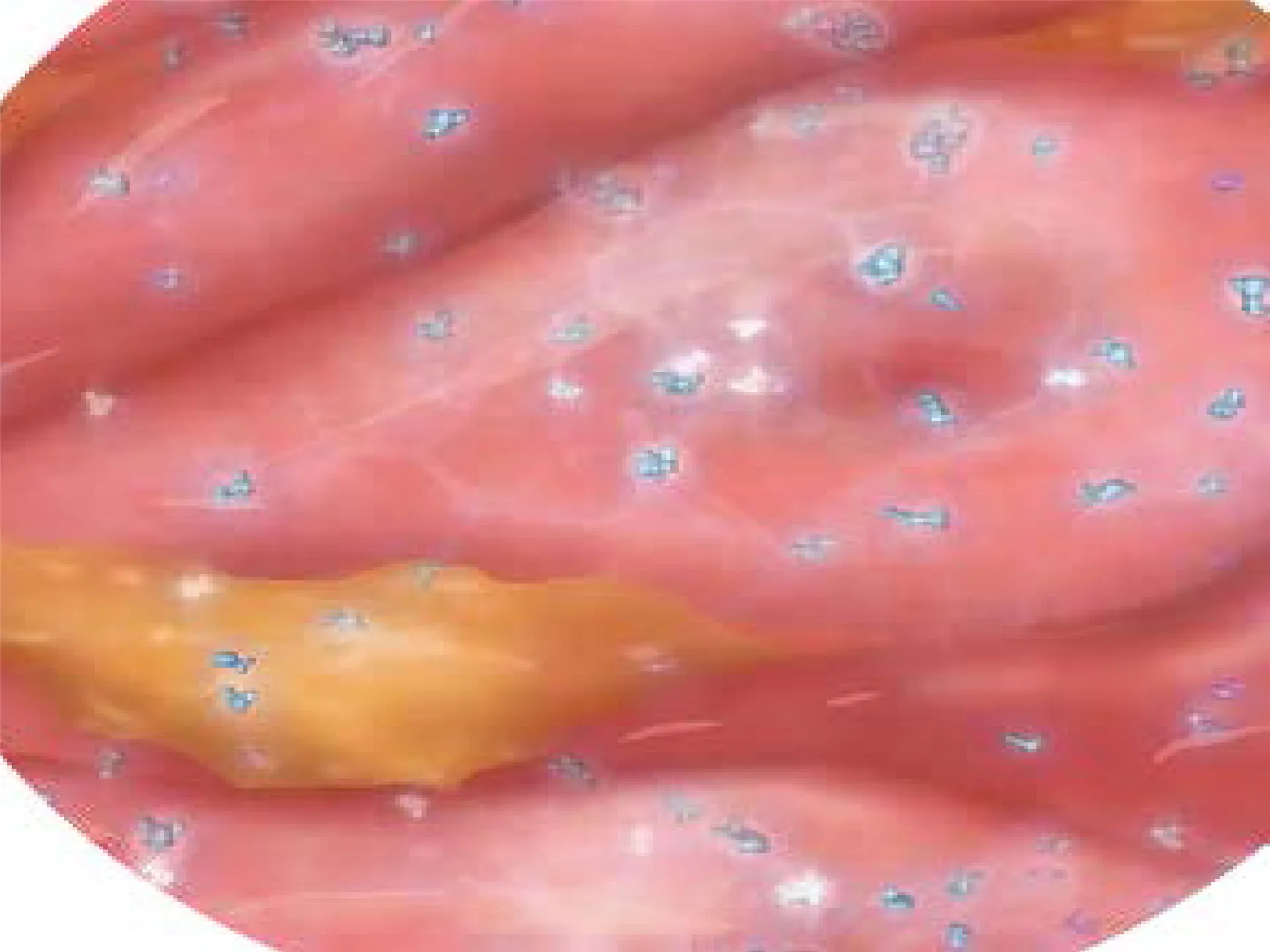 Girişimsel Radyoloji