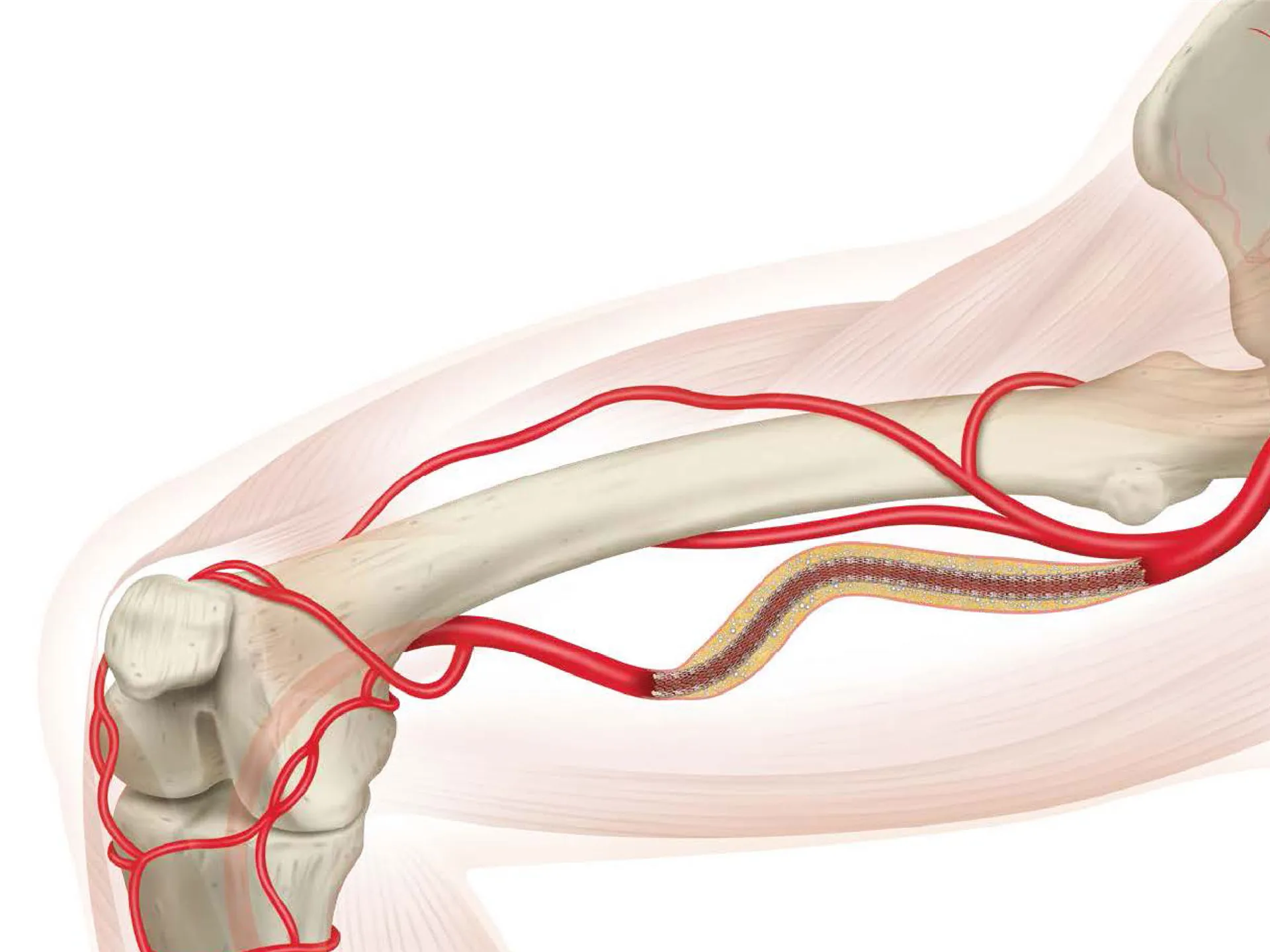 Girişimsel Radyoloji